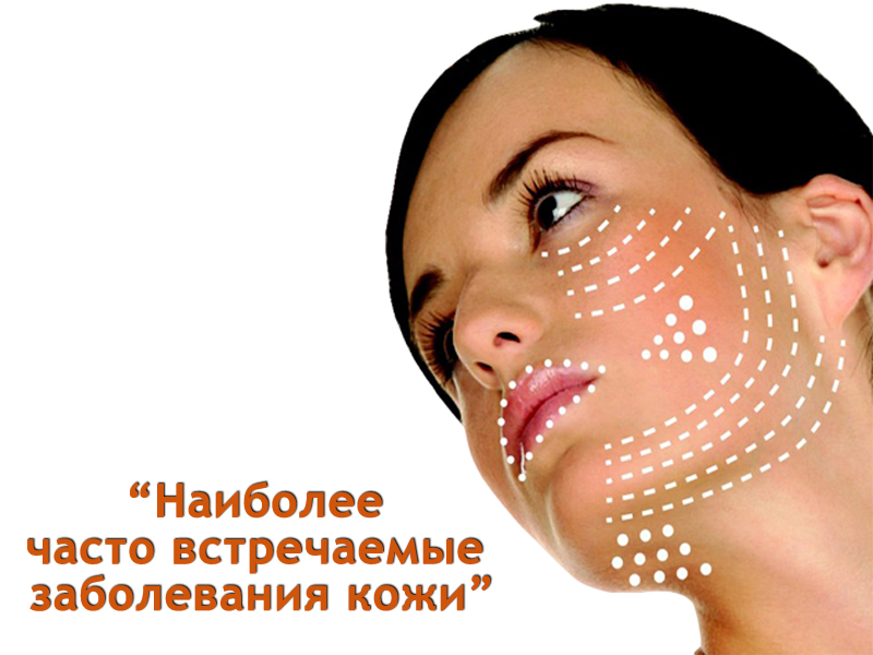 Soneil Studio Dermatologija dlja kosmetikov i kosmetologov