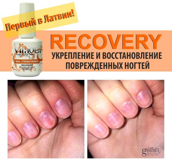 VitaGel RECOVERY – восстановление здоровья натурального ногтя. 